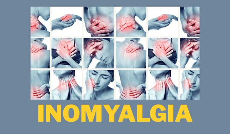 Understanding inomyalgia A Complete Guide to Symptoms and Treatment
