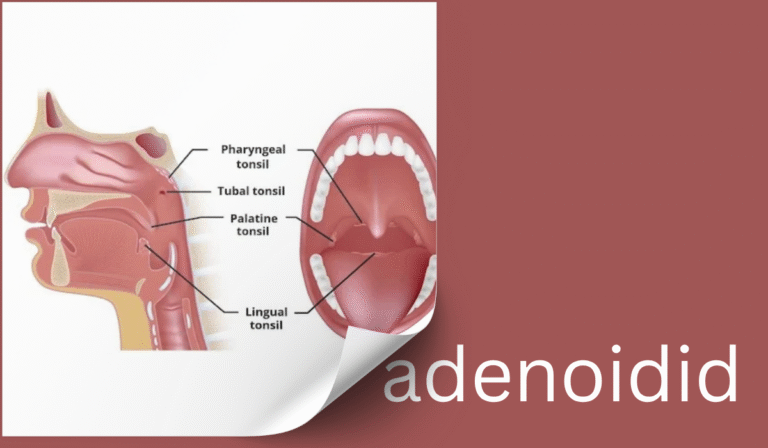 adenoidid